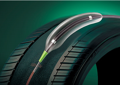 Wingy?球囊扩张导管