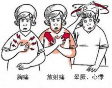 冠心病有哪些症状？