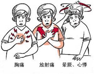 冠心病有哪些症状？(图1)
