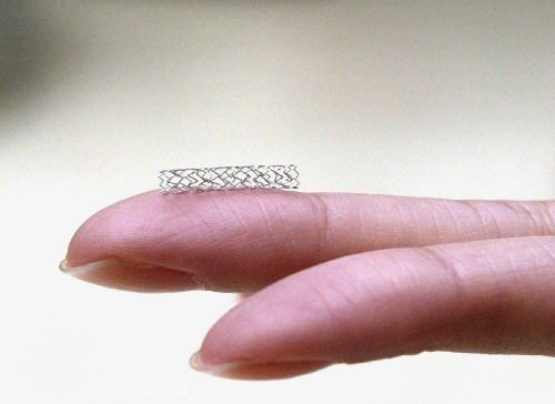 什么是金属裸支架？(图1)